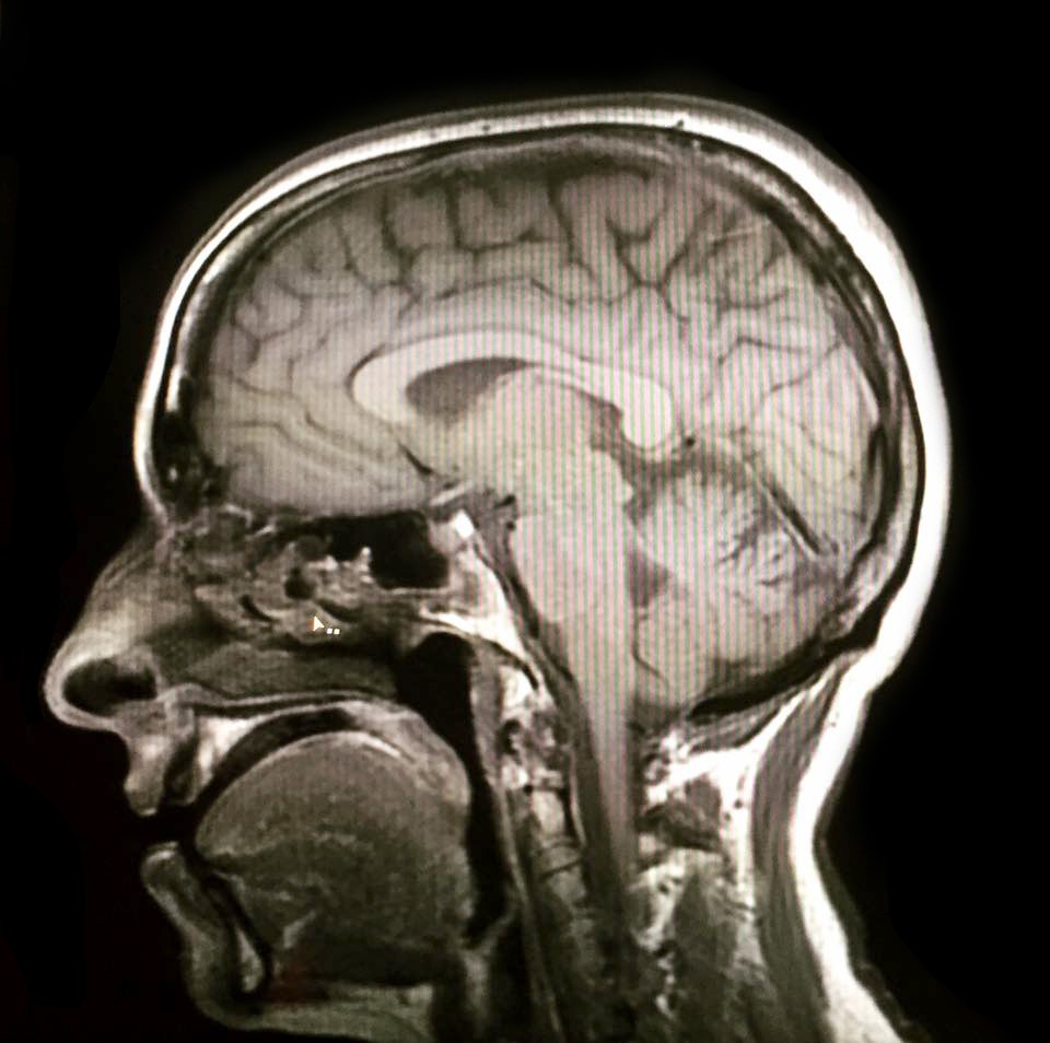 FFC MRI